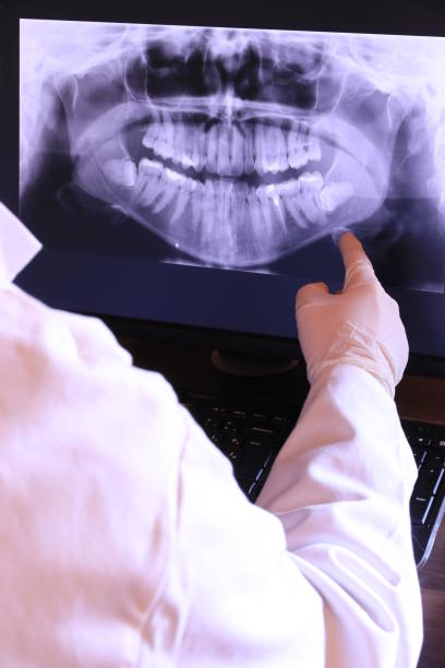 Best Emergency Treatment for Dental Infections or Abscesses in English Creek, NJ