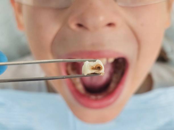 Best Weekend Emergency Dentist in English Creek, NJ