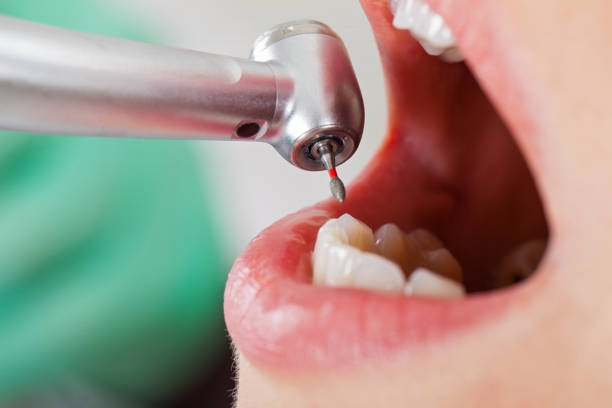 Best After-Hours Dental Trauma Care in English Creek, NJ